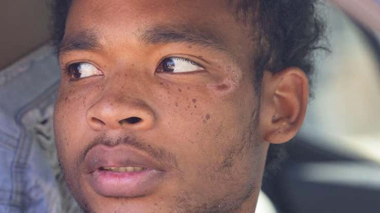Image for 21-Year-Old Texas Man Who Was Brutally Beaten During Arrest Speaks